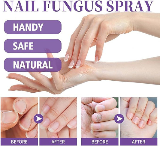 Jaysuin - Nail Fungus Spray