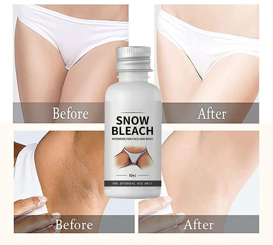 Dark Spot Remover Cream (30ml)